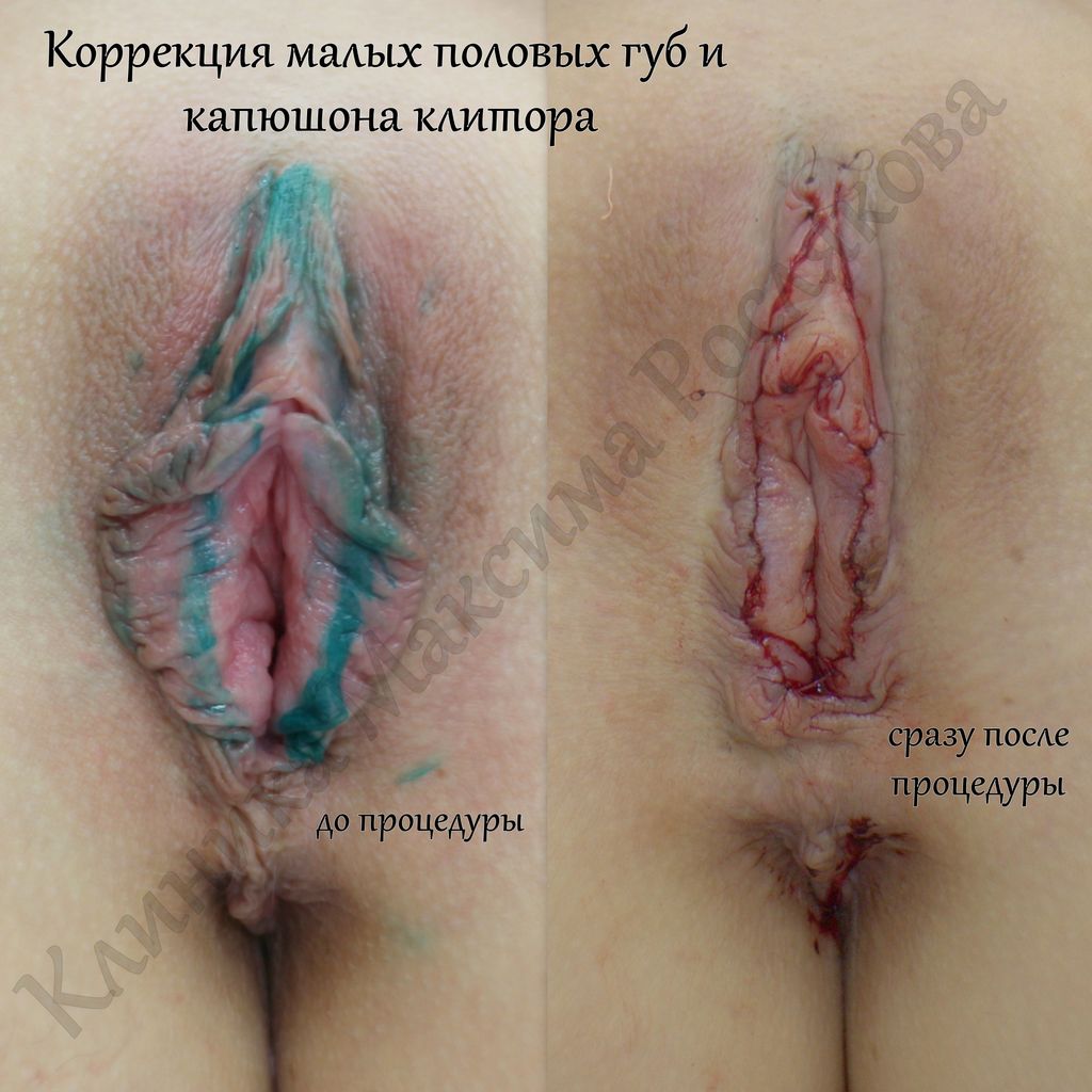 половое созревание от мастурбации фото 102